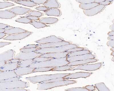 Immunohistochemistry-Paraffin: Dystrophin Antibody (JF1-022) [NBP2-66815] - Analysis of paraffin-embedded mouse skeletal muscle tissue with Rabbit anti-Dystrophin antibody washed with ddH2O and PBS, and then probed with the primary antibody  at 1/200 dilution for 1 hour at room temperature. The detection was performed using an HRP conjugated compact polymer system. DAB was used as the chromogen. Tissues were counterstained with hematoxylin and mounted with DPX.