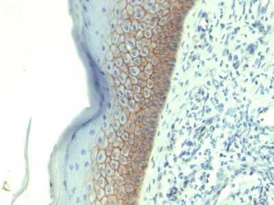 Immunohistochemistry-Paraffin: E-Cadherin Antibody (CDH1/1525) - Azide and BSA Free [NBP2-54551] - Formalin-fixed, paraffin-embedded human Skin stained with E-Cadherin Monoclonal Antibody (CDH1/1525).