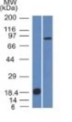 Western Blot: E-Cadherin Antibody (CDH1/1525) - Azide and BSA Free [NBP2-54551] - Analysis (A) Recombinant Protein (B) human Stomach lysate Using E-Cadherin Monoclonal Antibody (CDH1/1525).