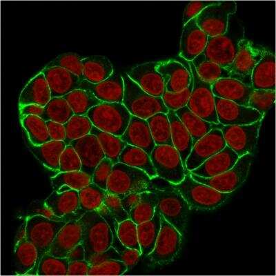 Immunocytochemistry/Immunofluorescence: E-Cadherin Antibody (CDH1/2208R) [NBP3-07902] - Immunofluorescence Analysis of MCF-7 cells labeling CHD1 with E-Cadherin Rabbit Recombinant Monoclonal Antibody (CDH1/2208R) followed by Goat anti-Mouse IgG-CF488 (Green). The nuclear counterstain is Reddot (Red).