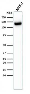 Western Blot: E-Cadherin Antibody (CDH1/2208R) [NBP3-07902] - Western Blot Analysis of MCF-7 cells using E-Cadherin Rabbit Recombinant Monoclonal Antibody (CDH1/2208R).