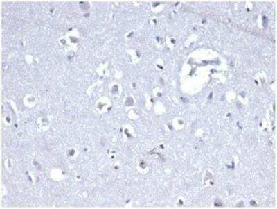 Immunohistochemistry-Paraffin: E-Cadherin Antibody (CDH1/4398R) [NBP3-11401] - IHC analysis of formalin-fixed, paraffin-embedded human brain. Negative tissue control using CDH1/4398R at 2ug/ml in PBS for 30min RT. HIER: Tris/EDTA, pH9.0, 45min. HRP-polymer, 30min. DAB, 5min.