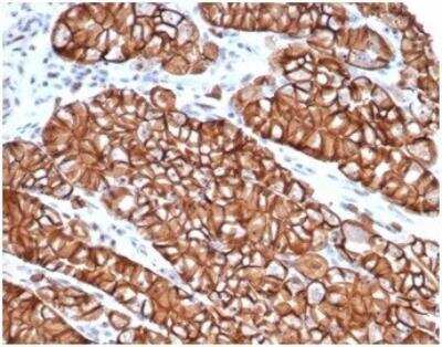 Immunohistochemistry-Paraffin: E-Cadherin Antibody (CDH1/4398R) [NBP3-11401] - Formalin-fixed, paraffin-embedded human cervix stained with E-Cadherin Rabbit Recombinant Monoclonal Antibody (CDH1/4398R).