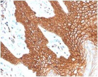 Immunohistochemistry-Paraffin: E-Cadherin Antibody (CDH1/4398R) [NBP3-11401] - Analysis of Protein Array containing more than 19,000 full-length human proteins using E-Cadherin Rabbit Recombinant Monoclonal Antibody (CDH1/4398R).