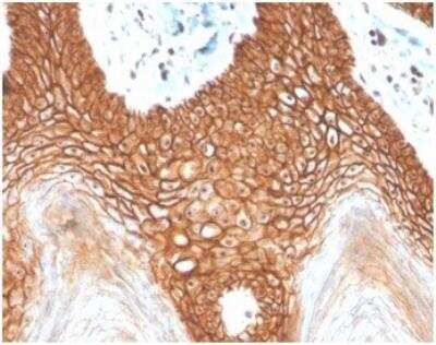 Immunohistochemistry-Paraffin: E-Cadherin Antibody (CDH1/4398R) [NBP3-11401] - Formalin-fixed, paraffin-embedded human cervix stained with E-Cadherin Rabbit Recombinant Monoclonal Antibody (CDH1/4398R).