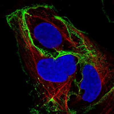 Immunocytochemistry/Immunofluorescence: E-Cadherin Antibody (CL1170) [NBP2-34475] - Staining of BEWO cells using the Anti-CDH1 monoclonal antibody, showing specific staining in the plasma membrane and cell junctions in green. Microtubule- and nuclear probes are visualized in red and blue, respectively (where available).