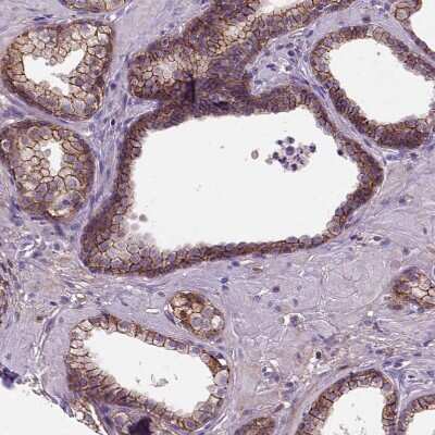 Immunohistochemistry-Paraffin: E-Cadherin Antibody (CL1170) [NBP2-34475] - Staining of human prostate shows strong membranous positivity in glandular cells.