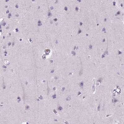 Immunohistochemistry-Paraffin: E-Cadherin Antibody (CL1170) [NBP2-34475] - Staining of human cerebral cortex shows no positivity in neuronal cells as expected.