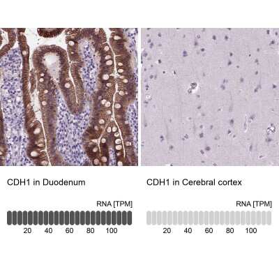 Immunohistochemistry-Paraffin: E-Cadherin Antibody (CL1170) [NBP2-34475] - Staining in human duodenum and cerebral cortex tissues. Corresponding CDH1 RNA-seq data are presented for the same tissues.