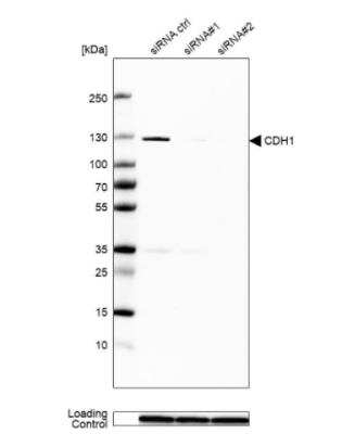 <b>Genetic Strategies Validation and Orthogonal Strategies Validation.</b>Western Blot: E-Cadherin Antibody (CL1170) [NBP2-34475] - Analysis in MCF-7 cells transfected with control siRNA, target specific siRNA probe #1 and #2, using Anti-CDH1 antibody. Remaining relative intensity is presented. Loading control: Anti-GAPDH