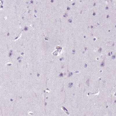 Immunohistochemistry-Paraffin: E-Cadherin Antibody (CL1172) [NBP2-34476] - Staining of human cerebral cortex shows no positivity in neuronal cells as expected.