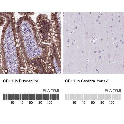 <b>Orthogonal Strategies Validation. </b>Immunohistochemistry-Paraffin: E-Cadherin Antibody (CL1172) [NBP2-34476] - Staining in human duodenum and cerebral cortex tissues. Corresponding CDH1 RNA-seq data are presented for the same tissues.