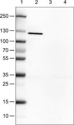 Western Blot: E-Cadherin Antibody (CL1172) [NBP2-34476] - Lane 1: Marker [kDa,Lane 2: Human cell line MCF-7, Lane 3: Human cell line SK-BR-3, Lane 4: Human cell line HeLa