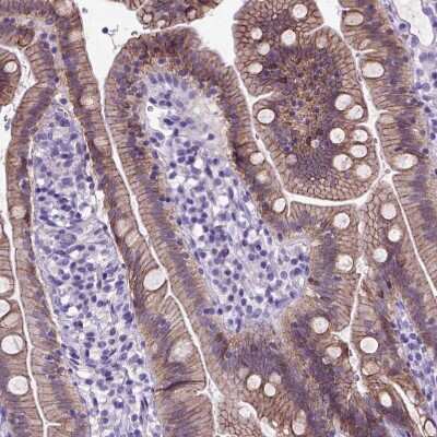 Immunohistochemistry-Paraffin: E-Cadherin Antibody (CL1180) [NBP2-34477] - Staining of human duodenum shows moderate membranous positivity in glandular cells.