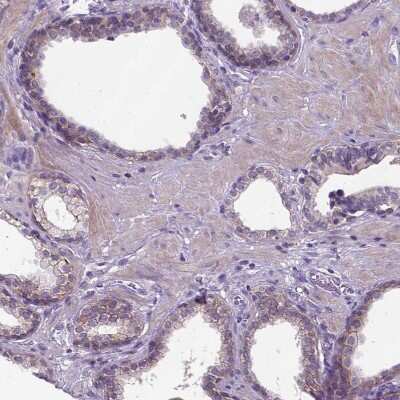 Immunohistochemistry-Paraffin: E-Cadherin Antibody (CL1180) [NBP2-34477] - Staining of human prostate shows moderate membranous positivity in glandular cells.