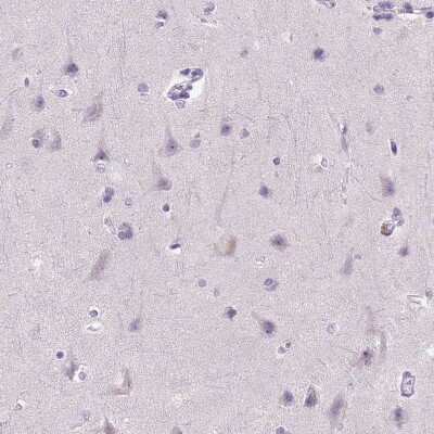 Immunohistochemistry-Paraffin: E-Cadherin Antibody (CL1180) [NBP2-34477] - Staining of human cerebral cortex shows no positivity in neuronal cells as expected.