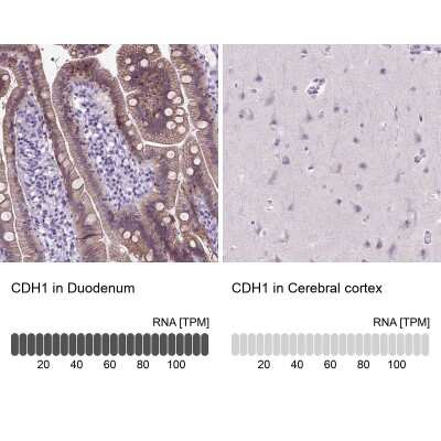 Immunohistochemistry-Paraffin: E-Cadherin Antibody (CL1180) [NBP2-34477] - Staining in human duodenum and cerebral cortex tissues. Corresponding CDH1 RNA-seq data are presented for the same tissues.