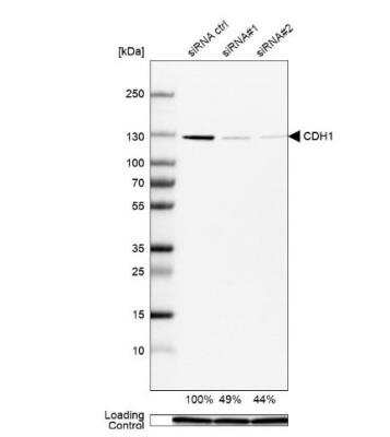 <b>Genetic Strategies Validation and Orthogonal Strategies Validation.</b>Western Blot: E-Cadherin Antibody (CL1180) [NBP2-34477] - Analysis in MCF-7 cells transfected with control siRNA, target specific siRNA probe #1 and #2, using Anti-CDH1 antibody. Remaining relative intensity is presented. Loading control: Anti-GAPDH.