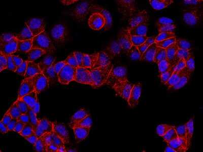 Immunocytochemistry/Immunofluorescence: E-Cadherin Antibody [NBP2-98433] - Immunofluorescence staining of E-Cadherin in MCF7 cells. Cells were fixed with 4% PFA, permeabilzed with 0.3% Triton X-100 in PBS, blocked with 10% serum, and incubated with rabbit anti-rat E-Cadherin polyclonal antibody (1:1000) at 4C overnight. Then cells were stained with the Alexa Fluor(R)594-conjugated Goat Anti-rabbit IgG Secondary antibody (red) and counterstained with DAPI (blue). Positive staining was localized to cell membrane and cytoplasm.