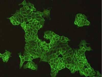 Immunocytochemistry/Immunofluorescence: E-Cadherin Antibody [NBP2-99061] - Immunofluorescence staining of Human E-Cadherin in MCF7 cells. Cells were fixed with 4% PFA, blocked with 10% serum, and incubated with rabbit anti-Human E-Cadherin polyclonal antibody (1:200). Then cells were stained with the Alexa Fluor(R) 488-conjugated Goat Anti-rabbit IgG Secondary antibody (green). Positive staining was localized to cells membrane.