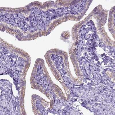 Immunohistochemistry-Paraffin: E-Cadherin Antibody [NBP1-84588] - Staining of human fallopian tube shows moderate positivity in  plasma membrane of glandular cells.