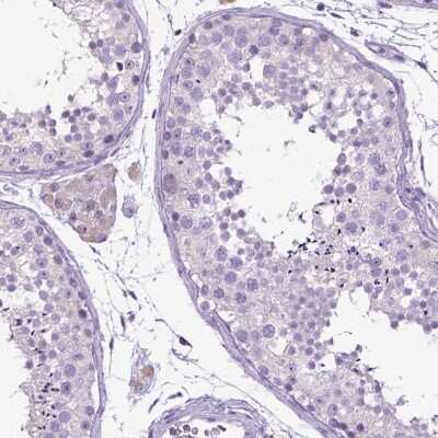 <b>Orthogonal Strategies Validation. </b>Immunohistochemistry-Paraffin: E-Cadherin Antibody [NBP1-84588] - Staining of human testis shows no positivity in cells in seminiferous ducts as expected.