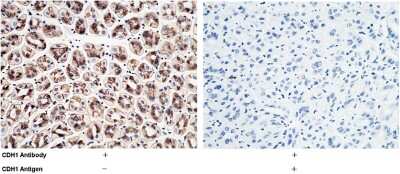 Immunohistochemistry-Paraffin: E-Cadherin Antibody [NBP2-98336] - Immunochemical staining of mouse E-Cadherin in mouse stomach with rabbit polyclonal antibody (1:1000, formalin-fixed paraffin embedded sections). The left panel: tissue incubated with primary antibody; The right panel: tissue incubated with the mixture of