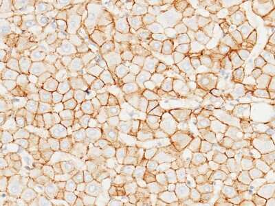 Immunohistochemistry-Paraffin: E-Cadherin Antibody [NBP2-99061] - Immunochemical staining of human E-Cadherin in human liver with rabbit polyclonal antibody (1:1000, formalin-fixed paraffin embedded sections).