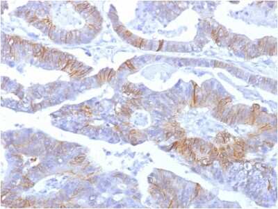 Immunohistochemistry-Paraffin: E-Cadherin Antibody (SPM381) - Azide and BSA Free [NBP2-54372] - Formalin-fixed, paraffin-embedded human colon stained with E-Cadherin Mouse Monoclonal Antibody (SPM381).
