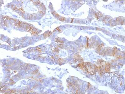 Immunohistochemistry-Paraffin: E-Cadherin Antibody (SPM381) [NBP2-53230] - Formalin-fixed, paraffin-embedded human colon stained with E-Cadherin Mouse Monoclonal Antibody (SPM381).