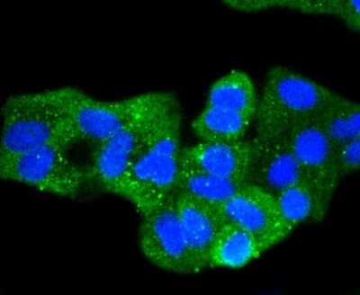 Immunocytochemistry/Immunofluorescence: E-Cadherin Antibody (ST54-01) [NBP2-67540] - Staining Pan-Cadherin in Hela cells (green). The nuclear counter stain is DAPI (blue). Cells were fixed in paraformaldehyde, permeabilised with 0.25% Triton X100/PBS.