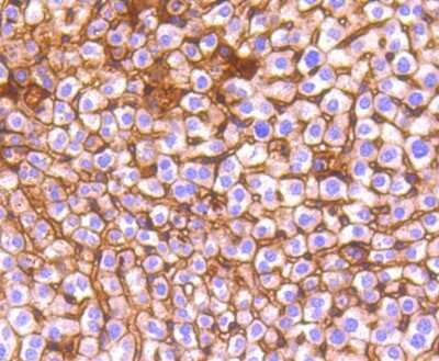 Immunohistochemistry-Paraffin: E-Cadherin Antibody (ST54-01) [NBP2-67540] - Analysis of paraffin-embedded mouse liver tissue using anti-Pan-Cadherin antibody. Counter stained with hematoxylin.