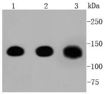 Western Blot: E-Cadherin Antibody (ST54-01) [NBP2-67540] - Analysis of Pan-Cadherin on different lysates using anti-Pan-Cadherin antibody at 1/1,000 dilution. Positive control: Lane 1: Human heart Lane 2: Mouse heart Lane 3: Rat heart