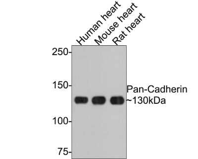 Western Blot: E-Cadherin Antibody (ST54-01) [NBP2-67540] - Analysis of E-Cadherin on different lysates with Rabbit anti-E-Cadherin antibody at 1/1,000 dilution. Lane 1: Human heart tissue lysate Lane 2: Mouse heart tissue lysate Lane 3: Rat heart tissue lysate Lysates/proteins at 20 ug/Lane. Predicted band size: 100 kDa Observed band size: 130 kDa Exposure time: 1 minute; 6% SDS-PAGE gel. Proteins were transferred to a PVDF membrane and blocked with 5% NFDM/TBST for 1 hour at room temperature. The primary antibody at 1/1,000 dilution was used in 5% NFDM/TBST at room temperature for 2 hours. Goat Anti-Rabbit IgG - HRP Secondary Antibody at 1:300,000 dilution was used for 1 hour at room temperature.