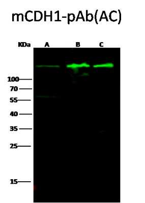 Western Blot: E-Cadherin Antibody [NBP2-98336] - Anti-E-Cadherin rabbit polyclonal antibody at 1:500 dilution. Lane A: A431 Whole Cell Lysate. Lane B: MCF7 Whole Cell Lysate. Lane C: MDA-MB-468 Whole Cell Lysate. Lysates/proteins at 30 ug per lane. Secondary Goat Anti-Rabbit IgG H&L (Dylight 800) at 1/10000 dilution. Developed using the Odyssey technique. Performed under reducing conditions. Predicted band size: 97 kDa. Observed band size: 150 kDa