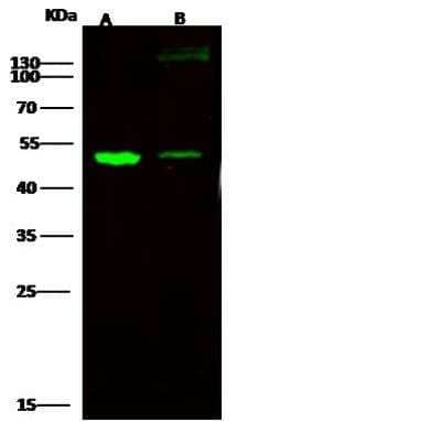 Western Blot: E-Cadherin Antibody [NBP2-98433] - Lane A: MCF7 Whole Cell LysateLane B: Caco-2 Whole Cell LysateLysates/proteins at 30 ug per lane.SecondaryGoat Anti- Rabbit  IgG H&L (Dylight 800)  at 1/10000 dilution.Developed using the Odyssey technique. Performed under reducing conditions.Predicted band size:55 kDaObserved band size:50 kDa