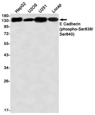 Western Blot: E-Cadherin [p Ser838, p Ser840] Antibody (S03-3B3) [NBP3-19826] - Western blot detection of E-Cadherin (phospho-Ser838/Ser840) in HepG2, U2OS, U251, Lncap using NBP3-19826 (1:1000 diluted)