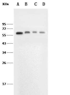 Western Blot: E-Selectin/CD62E Antibody (015) [NBP2-90702] - Lane A: Jurkat Whole Cell LysateLane B: Mouse liver tissue lysateLane C: Mouse spleen tissue lysateLane D: Mouse brain tissue lysateLysates/proteins at 30 ug per lane.SecondaryGoat Anti-Rabbit IgG (H+L)/HRP at 1/10000 dilution.Developed using the ECL technique.Performed under reducing conditions.Predicted band size:67 kDaObserved band size:67 kDa
