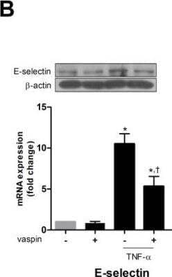 Western Blot: E-Selectin/CD62E Antibody [NBP1-45545] - Vaspin inhibits TNFalpha-induced expression of adhesion molecules. The effect of vaspin on TNFalpha-induced expression of E-Selectin/CD62E. The protein level and mRNA expression of each adhesion molecule was measured at 24 hr after treatment with 100 ng/mL vaspin in the presence or absence of 10 ng/mL TNFalpha. Data shown are representative Western blots (top panels) and mean values +/- SEM of three independent experiments (bottom panels). The fold change in mRNA expression compared to levels in untreated cells is shown. *p < 0.05 vs. untreated cells, and p < 0.05 vs. cells treated with TNFalpha alone. Image collected and cropped by CiteAb from the following publication (//pubmed.ncbi.nlm.nih.gov/24517399) licensed under a CC-BY license.