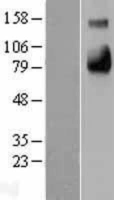 Western Blot E-Selectin/CD62E Overexpression Lysate