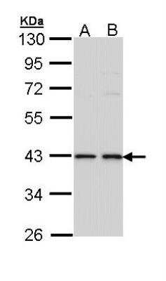 Western Blot: E2F-1 Antibody [NBP1-31394] - Sample (30 ug of whole cell lysate) A: A431 B: H1299 10% SDS PAGE; antibody diluted at 1:1000.