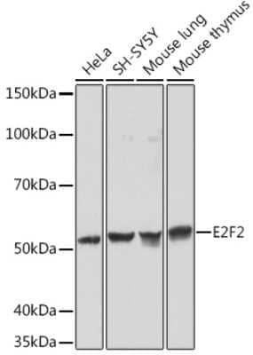 Western Blot: E2F-2 Antibody (1H7D6) [NBP3-16165] - Western blot analysis of extracts of various cell lines, using E2F-2 Rabbit mAb (NBP3-16165) at 1:1000 dilution. Secondary antibody: HRP Goat Anti-Rabbit IgG (H+L) at 1:10000 dilution. Lysates/proteins: 25ug per lane. Blocking buffer: 3% nonfat dry milk in TBST. Detection: ECL Basic Kit. Exposure time: 1min.