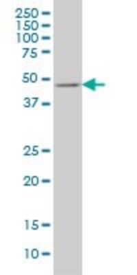 Western Blot: E2F3 Antibody (5F7) [H00001871-M01] - E2F3 monoclonal antibody (M01), clone 5F7 Analysis of E2F3 expression in COLO 320 HSR.