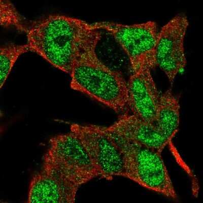 Immunocytochemistry/Immunofluorescence: E2F3 Antibody [NBP2-57709] - Staining of human cell line SH-SY5Y shows localization to nucleoplasm.