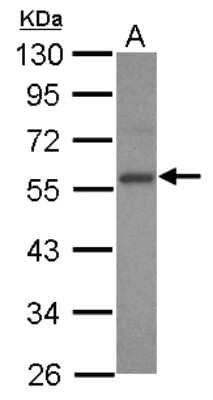 Western Blot: E2F3 Antibody [NBP2-16251] - Sample (30 ug of whole cell lysate) A: 293T 10% SDS PAGE gel, diluted at 1:1000.