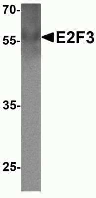 Western Blot: E2F3 Antibody [NBP2-81745] - Western blot analysis of E2F3 in human lymph node tissue lysate with E2F3 antibody at 1 ug/ml.