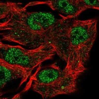 Immunocytochemistry/ Immunofluorescence E2F5 Antibody