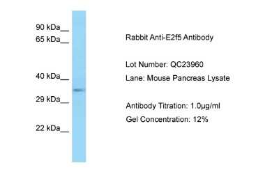 Western Blot: E2F5 Antibody [NBP2-82954] - Host: Rabbit. Target Name: E2f5. Sample Type: Mouse Pancreas. Antibody Dilution: 1.0ug/ml