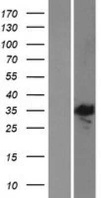 Western Blot E2F5 Overexpression Lysate