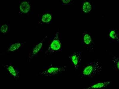 Immunocytochemistry/Immunofluorescence: E2F6 Antibody [NBP2-98788] - Immunofluorescence staining of E2F6 in HeLa cells. Cells were fixed with 4% PFA, permeabilzed with 0.3% Triton X-100 in PBS, blocked with 10% serum, and incubated with rabbit anti-human E2F6 polyclonal antibody (1:5000) at 4C overnight. Then cells were stained with the Alexa Fluor(R)488-conjugated Goat Anti-rabbit IgG secondary antibody (green).Positive staining was localized to nucleus.
